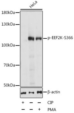 Invitrogen Phospho-EEF2K (Ser366) Polyclonal Antibody 100 &mu;L; Unconjugated:Antibodies,