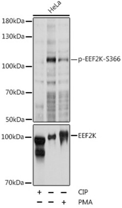 Invitrogen Phospho-EEF2K (Ser366) Polyclonal Antibody 100 &mu;L; Unconjugated:Antibodies,