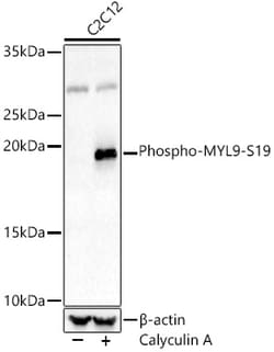Invitrogen Phospho-MYL9 (Ser19) Polyclonal Antibody 100 &mu;L; Unconjugated:Antibodies,