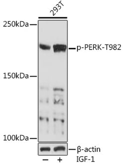 Invitrogen Phospho-PERK (Thr982) Polyclonal Antibody 100 &mu;L; Unconjugated:Antibodies,