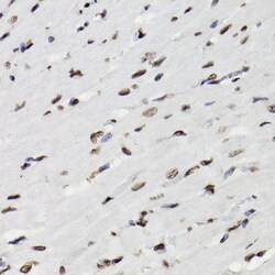 Invitrogen Phospho-STAT5A/B (Tyr694) Polyclonal Antibody 100 &mu;L; Unconjugated:Antibodies,