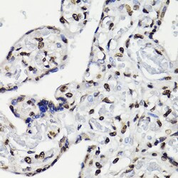 Invitrogen Phospho-STAT5A/B (Tyr694) Polyclonal Antibody 100 &mu;L; Unconjugated:Antibodies,