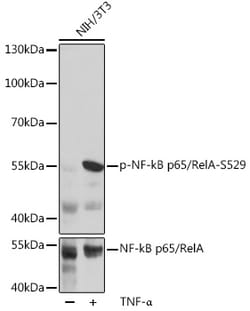 Invitrogen Phospho-NFkB p65 (Ser529) Polyclonal Antibody 100 &mu;L; Unconjugated:Antibodies,