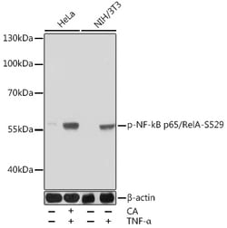 Invitrogen Phospho-NFkB p65 (Ser529) Polyclonal Antibody 100 &mu;L; Unconjugated:Antibodies,