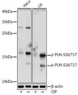 Invitrogen Phospho-Phospholamban (Ser16, Thr17) Polyclonal Antibody 100