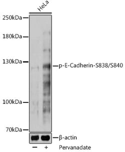 Invitrogen Phospho-E-cadherin (Ser838, Ser840) Polyclonal Antibody 100