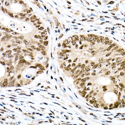Invitrogen Phospho-FOXO1 (Ser319) Polyclonal Antibody 100 &mu;L; Unconjugated:Antibodies,