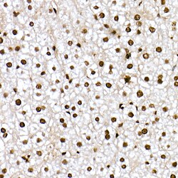 Invitrogen Phospho-FOXO1 (Ser319) Polyclonal Antibody 100 &mu;L; Unconjugated:Antibodies,