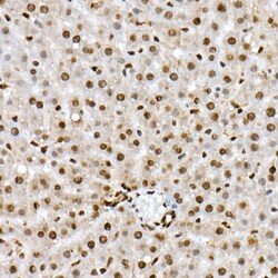 Invitrogen Phospho-FOXO1 (Ser319) Polyclonal Antibody 100 &mu;L; Unconjugated:Antibodies,
