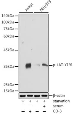 Invitrogen Phospho-LAT (Tyr191) Polyclonal Antibody 100 &mu;L; Unconjugated:Antibodies,