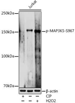 Invitrogen Phospho-ASK1 (Ser967) Polyclonal Antibody 100 &mu;L | Buy Online | Invitrogen&trade; | Fisher Scientific