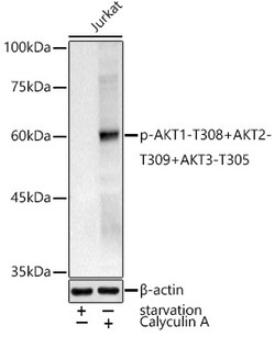 Invitrogen Phospho-AKT1 (Thr308) Polyclonal Antibody 100 &mu;L; Unconjugated:Antibodies,