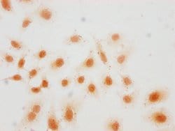 Invitrogen H3K36hib Polyclonal Antibody 100 &mu;L | Buy Online | Invitrogen&trade; | Fisher Scientific