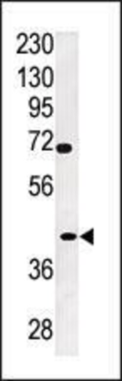 Invitrogen TPST2 Polyclonal Antibody 400 μL; Unconjugated:Antibodies,