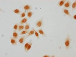 Invitrogen Acetyl-HIST1H2AG (Lys15) Polyclonal Antibody 100 μL; Unconjugated:Antibodies,