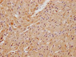 C22orf39 Polyclonal Antibody 100 &mu;L | Buy Online | Thermo Scientific | Fisher Scientific