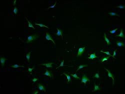 Invitrogen CCHCR1 Polyclonal Antibody 100 &mu;L | Buy Online | Invitrogen&trade; | Fisher Scientific