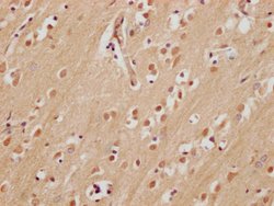 Invitrogen FAM53A Polyclonal Antibody 100 &mu;L | Buy Online | Invitrogen&trade; | Fisher Scientific