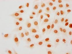 Invitrogen H3K18for Polyclonal Antibody 100 μL; Unconjugated:Antibodies,
