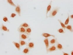 H3K79for Polyclonal Antibody:Antibodies, Polyclonal