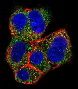Invitrogen AGL Polyclonal Antibody 400 &mu;L; Unconjugated:Antibodies,
