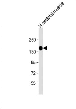 Invitrogen AGL Polyclonal Antibody 400 &mu;L; Unconjugated:Antibodies,