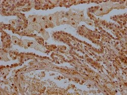 Invitrogen LTC4S Polyclonal Antibody 100 &mu;L | Buy Online | Invitrogen&trade; | Fisher Scientific