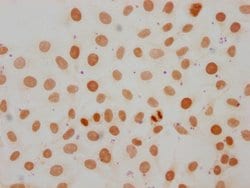 Invitrogen Mono-Methyl-Histone 1F0 (Lys107) Polyclonal Antibody 100 &mu;L;
