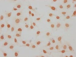 Invitrogen Mono-Methyl-Histone 1F0 (Lys11) Polyclonal Antibody 100 &mu;L;