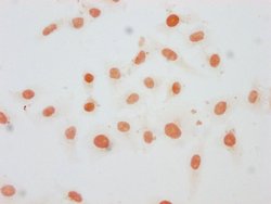 Invitrogen Mono-Methyl-Histone H1.1 (Lys21) Polyclonal Antibody 100 &mu;L;