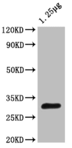 Invitrogen Trehalose-6-phosphate phosphatase Polyclonal Antibody 100 &mu;L;