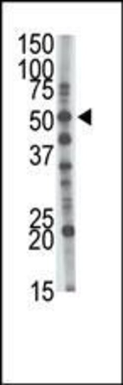 Invitrogen GCNT1 Polyclonal Antibody 400 &mu;L; Unconjugated:Antibodies,