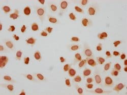 Invitrogen Phospho-Histone H1.5 (Ser172) Polyclonal Antibody 100 &mu;L;