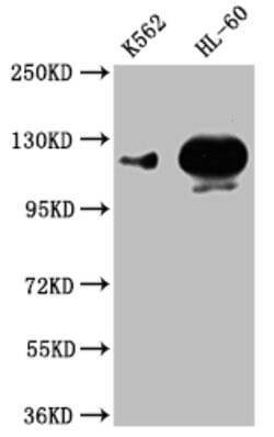 Invitrogen POTEE Polyclonal Antibody 100 &mu;L; Unconjugated:Antibodies,