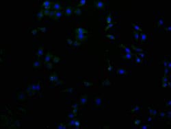 Invitrogen RHBDF2 Polyclonal Antibody 100 &mu;L; Unconjugated:Antibodies,