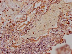 RNF122 Polyclonal Antibody:Antibodies, Polyclonal