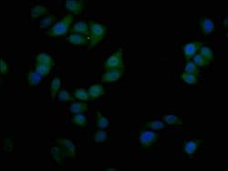 Invitrogen SIM1 Polyclonal Antibody 100 &mu;L; Unconjugated:Antibodies,