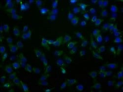 Invitrogen SLC23A2 Polyclonal Antibody 100 μL; Unconjugated:Antibodies,