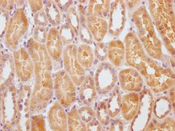 Invitrogen STATH Polyclonal Antibody 100 &mu;L; Unconjugated:Antibodies,
