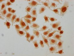 Invitrogen Succinyl-HIST1H2AG (Lys95) Polyclonal Antibody 100 &mu;L; Unconjugated:Antibodies,