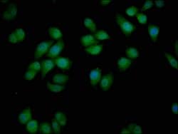 Invitrogen VDAC3 Polyclonal Antibody 100 μL; Unconjugated:Antibodies,