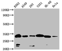 Invitrogen VDAC3 Polyclonal Antibody 100 μL; Unconjugated:Antibodies,