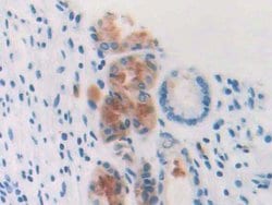 Invitrogen Profilin 3 Polyclonal Antibody, Invitrogen 100 &mu;L; Unconjugated:Antibodies,