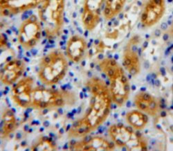 Profilin 3 Polyclonal Antibody, Invitrogen:Antibodies:Primary Antibodies