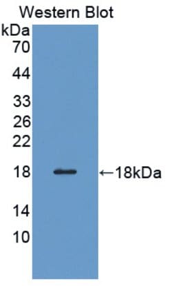 Invitrogen Profilin 3 Polyclonal Antibody, Invitrogen 100 &mu;L; Unconjugated:Antibodies,