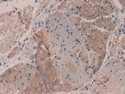 MYH16 Polyclonal Antibody, Invitrogen:Antibodies:Primary Antibodies