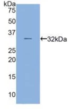 MYH16 Polyclonal Antibody, Invitrogen:Antibodies:Primary Antibodies