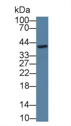 Invitrogen CTRB2 Polyclonal Antibody, Invitrogen 20 &mu;L | Buy Online | Invitrogen&trade; | Fisher Scientific