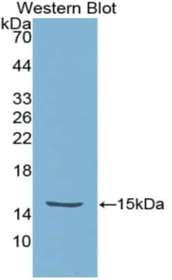Invitrogen HTRA1 Polyclonal Antibody, Invitrogen 20 &mu;L; Unconjugated:Antikroppar