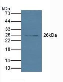 Invitrogen Trypsin 2 Polyclonal Antibody, Invitrogen 100 &mu;L; Unconjugated:Antibodies,
